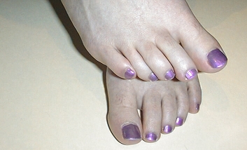 Mary's purple toe nails